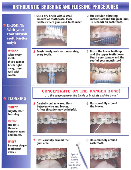 Tooth Brushing Instructions with Braces 460 x 597 · 262 kB · jpeg