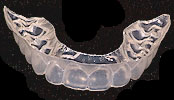 clear retainer in orthodontics